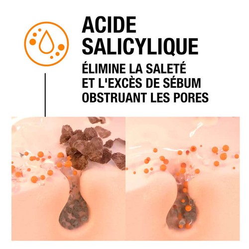 Neutrogena Gel SOS anti acné 15ml